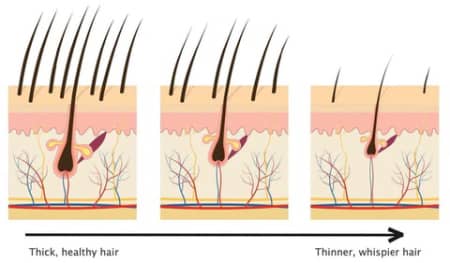 Density of hair