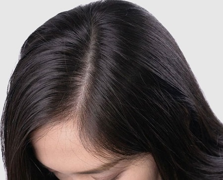 a-healthier-scalp