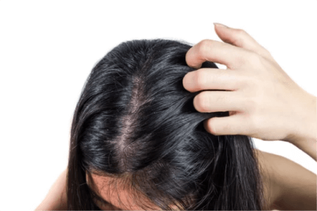 a-woman-with-an-oily-scalp