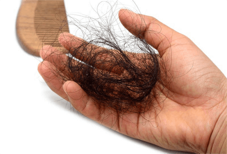 hair-loss