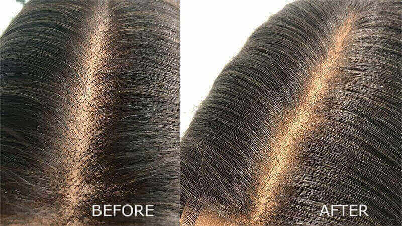 Bleach Knots On Lace Closure: Should Or Should Not - Anka Hair