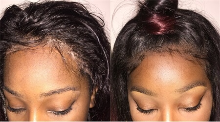 How to fix lifted lace front: beginner friendly 